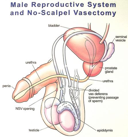 Premium Vector  Male vasectomy anatomy of the male reproductive system